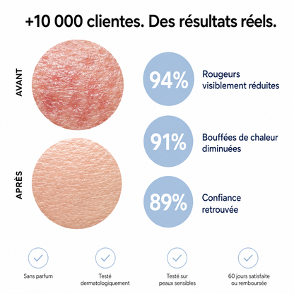 Rosyra Sérum Anti-Rougeurs