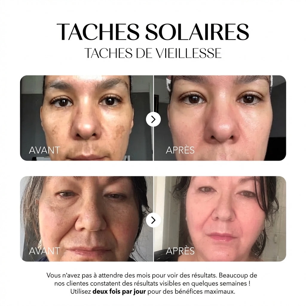 Rosyra Sérum Anti-Taches