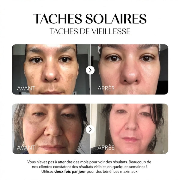 Rosyra Sérum Anti-Taches
