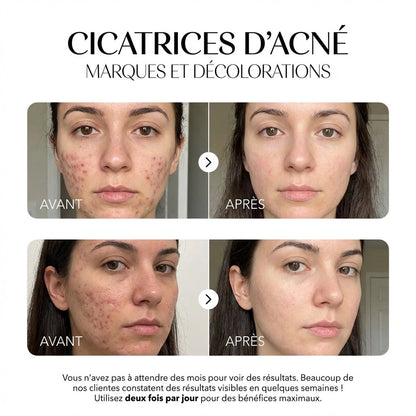 Rosyra Sérum Anti-Taches