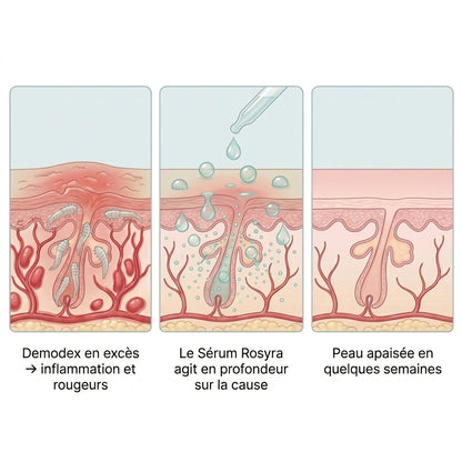 Rosyra Sérum Anti-Rougeurs